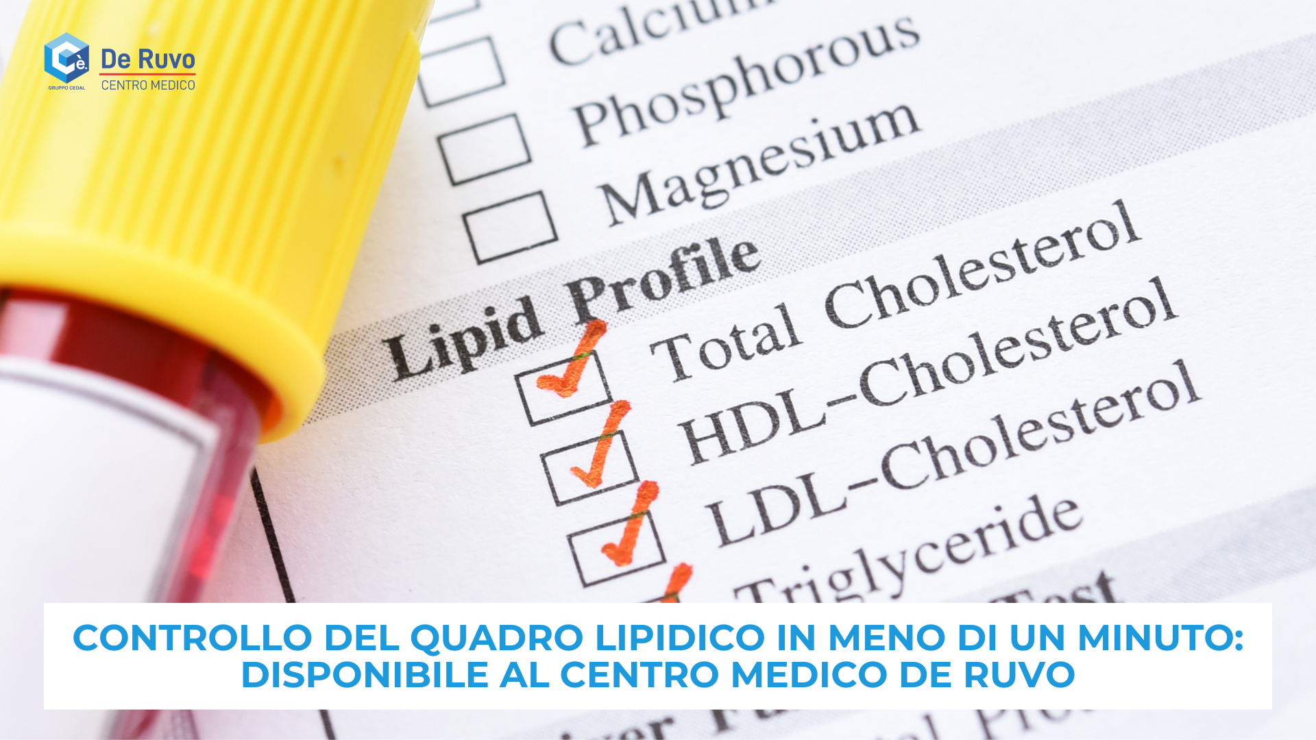 Controllo del quadro lipidico in meno di un minuto: disponibile al Centro Medico De Ruvo