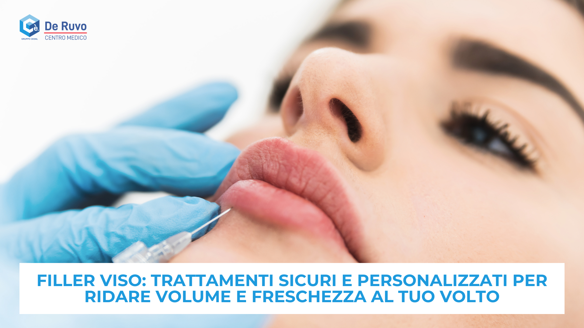 Filler viso: trattamenti sicuri e personalizzati per ridare volume e freschezza al tuo volto