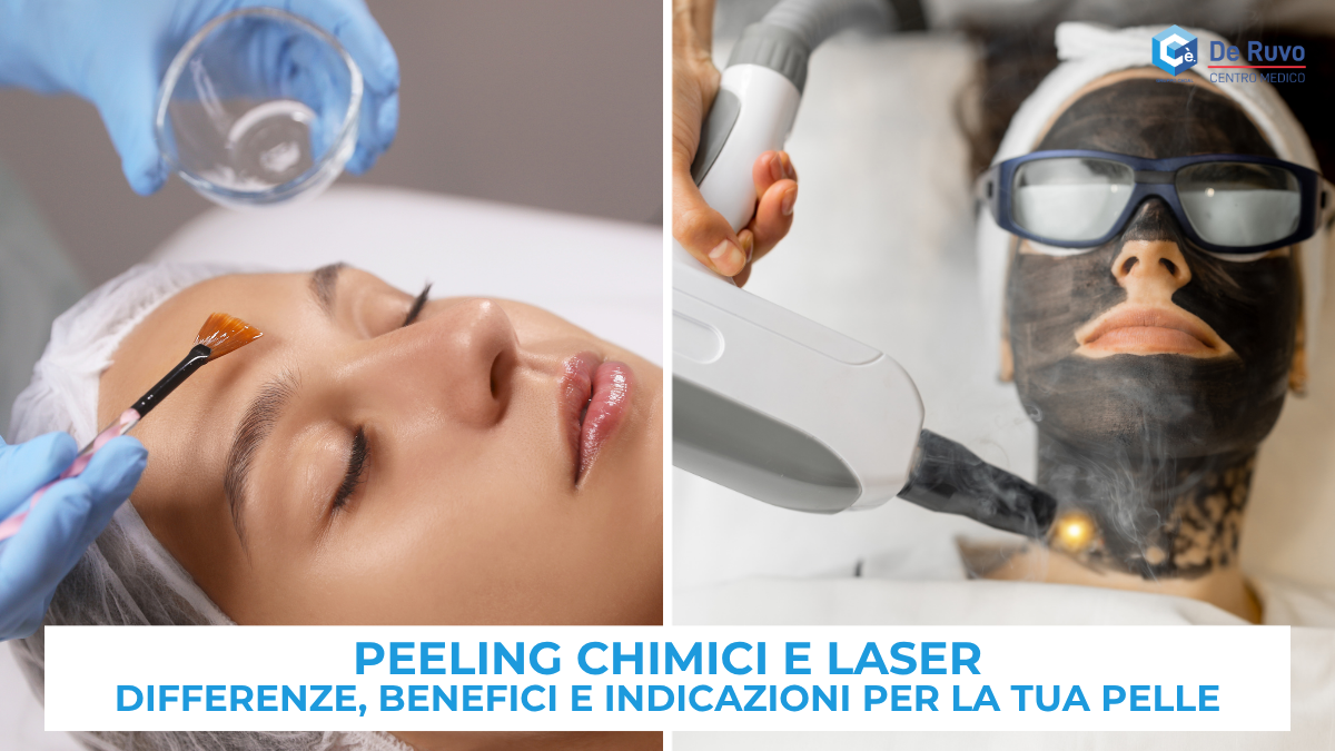 Peeling chimici e laser: differenze, benefici e indicazioni per la tua pelle